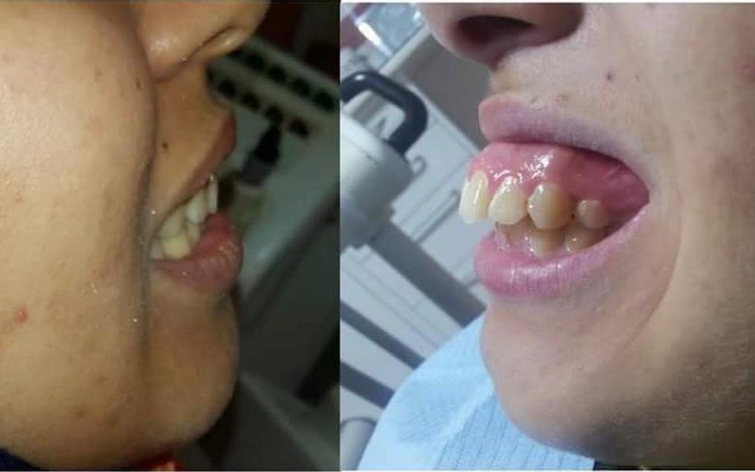 Dentiste à Rabat – adresses, avis et RDV