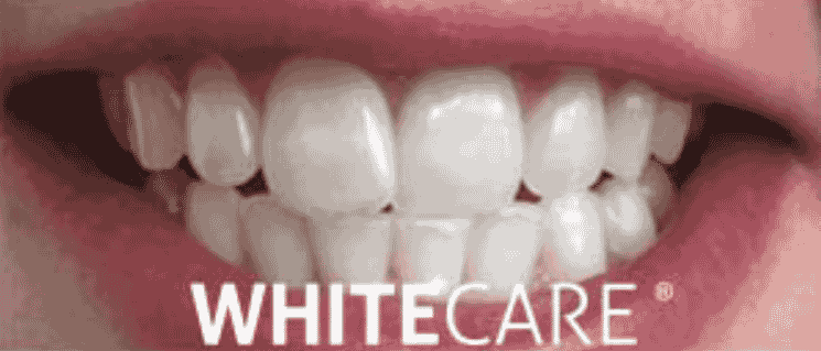 Après — Blanchiment dentaire WHITECARE